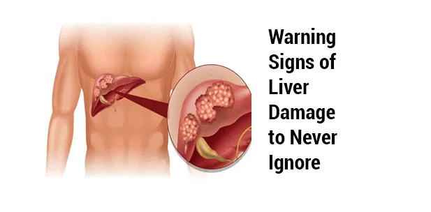 Signs of Liver Damage