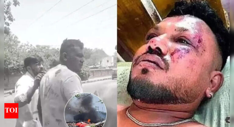 Ahmedabad Plane Crash: Lone survivor Viswashkumar Ramesh discharged from hospital | Ahmedabad News – Times of India