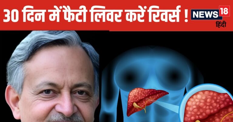 Fatty Liver Treatment Tips by Dr. SK Sarin | एक महीने में लिवर फैट हटाने के आसान तरीके